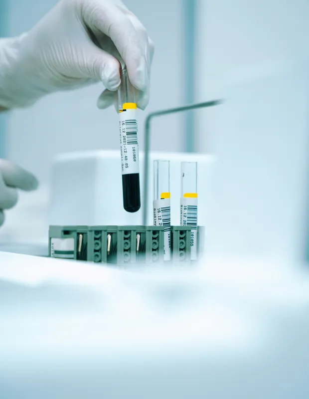 Laboratory sample handling
